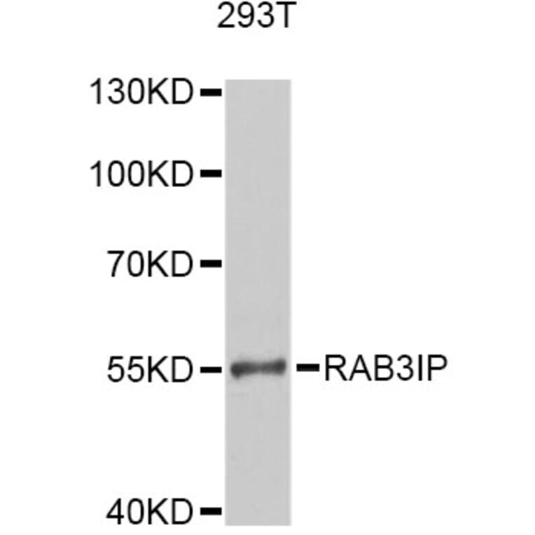 Western Blot - Anti-RAB3IP Antibody (A12608) - Antibodies.com