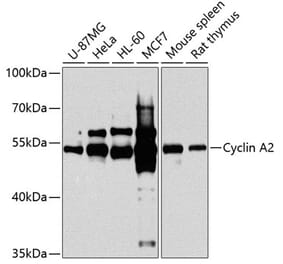 Western Blot - Anti-Cyclin A2 Antibody (A90478) - Antibodies.com