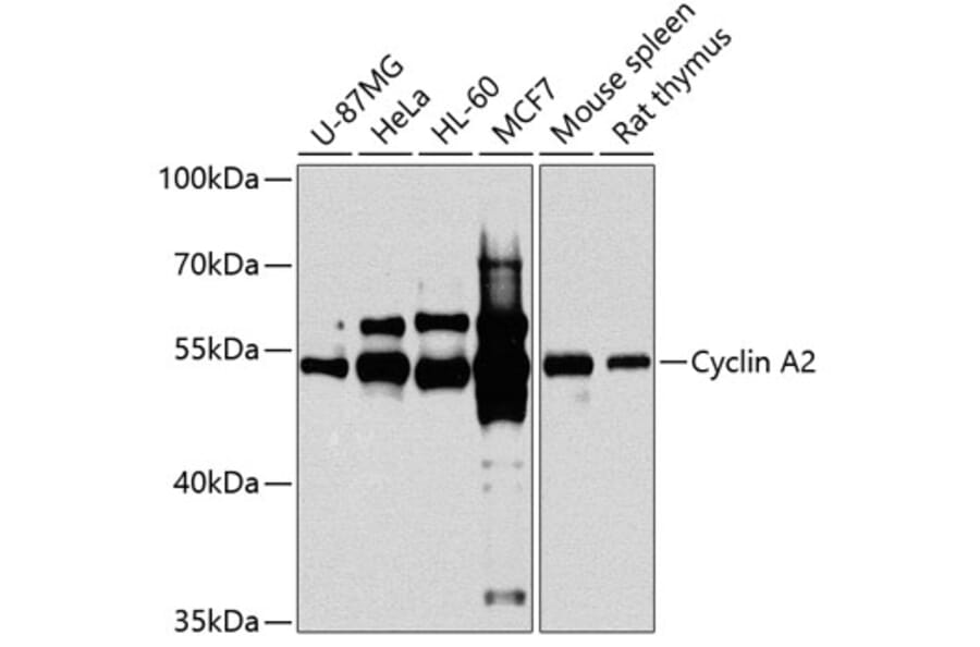 Western Blot - Anti-Cyclin A2 Antibody (A90478) - Antibodies.com