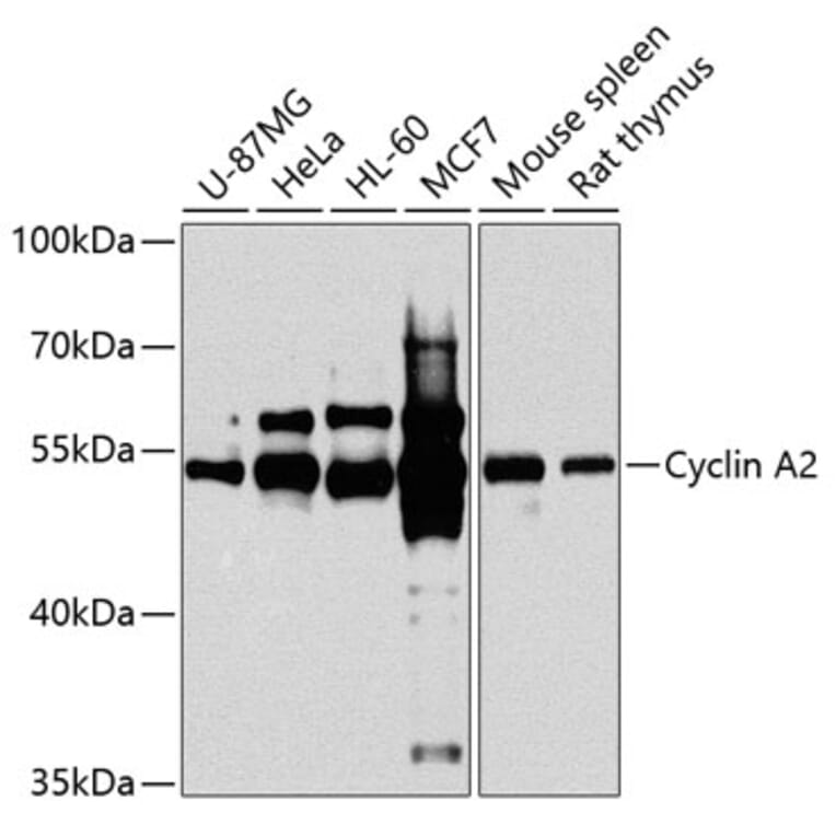 Western Blot - Anti-Cyclin A2 Antibody (A90478) - Antibodies.com