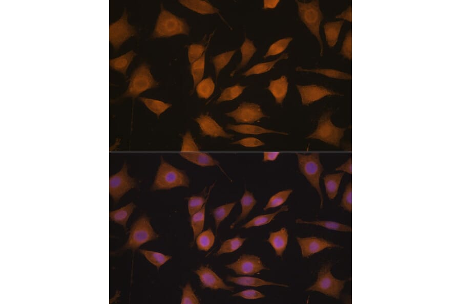 Immunofluorescence - Anti-Cyclin A2 Antibody (A90478) - Antibodies.com