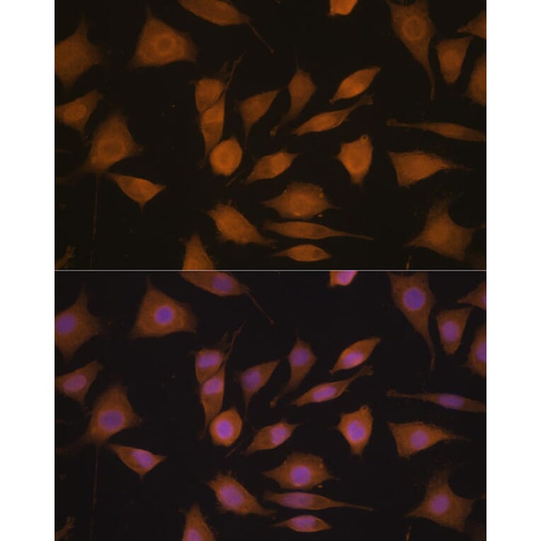 Immunofluorescence - Anti-Cyclin A2 Antibody (A90478) - Antibodies.com