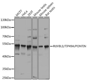 Western Blot - Anti-TIP49A Antibody (A90479) - Antibodies.com