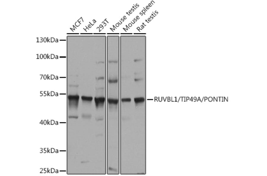 Western Blot - Anti-TIP49A Antibody (A90479) - Antibodies.com