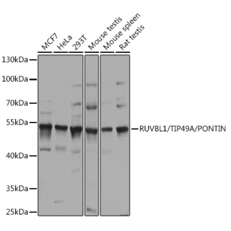 Western Blot - Anti-TIP49A Antibody (A90479) - Antibodies.com