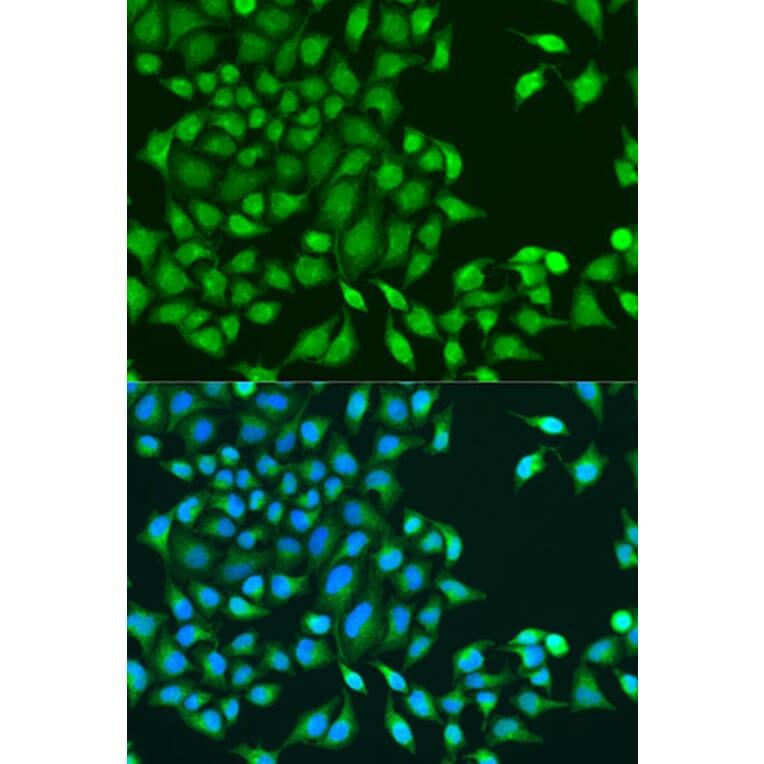 Immunofluorescence - Anti-TIP49A Antibody (A90479) - Antibodies.com