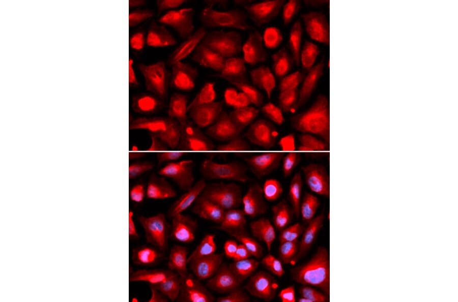 Immunofluorescence - Anti-ETS1 Antibody (A13302) - Antibodies.com