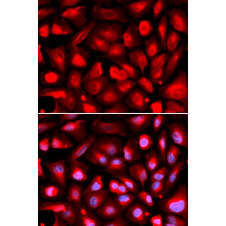 Immunofluorescence - Anti-ETS1 Antibody (A13302) - Antibodies.com
