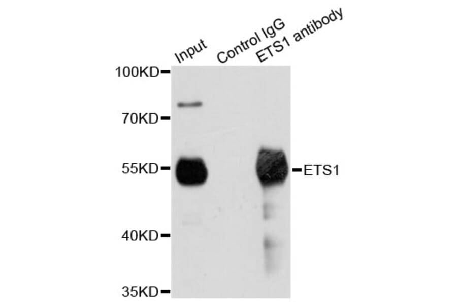 Immunoprecipitation - Anti-ETS1 Antibody (A13302) - Antibodies.com