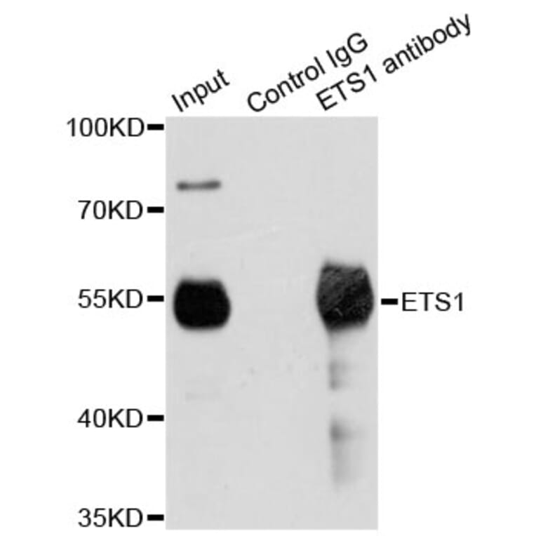 Immunoprecipitation - Anti-ETS1 Antibody (A13302) - Antibodies.com