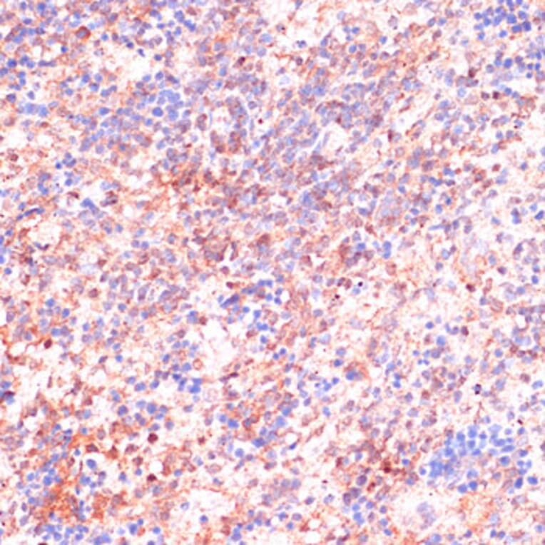 Immunohistochemistry - Anti-Cdc20 Antibody (A90481) - Antibodies.com