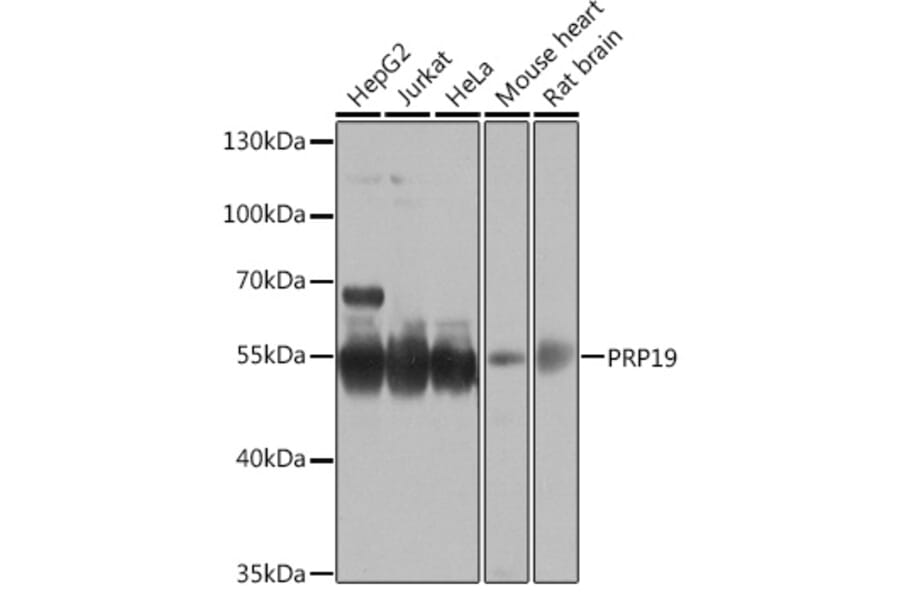 Western Blot - Anti-PRP19 Antibody (A90482) - Antibodies.com