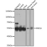 Western Blot - Anti-PRP19 Antibody (A90482) - Antibodies.com