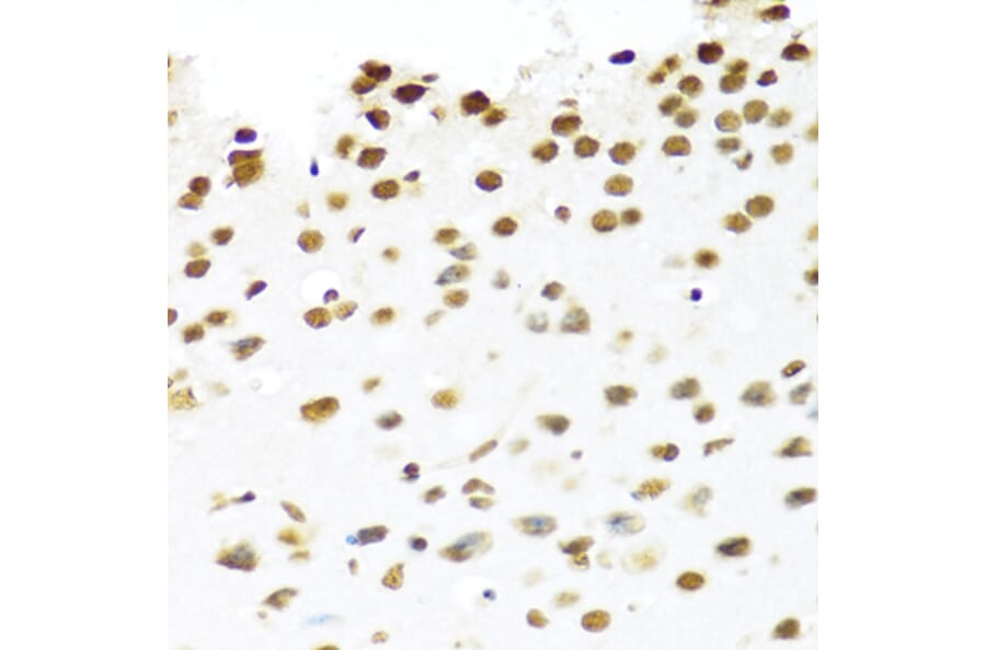 Immunohistochemistry - Anti-PRP19 Antibody (A90482) - Antibodies.com