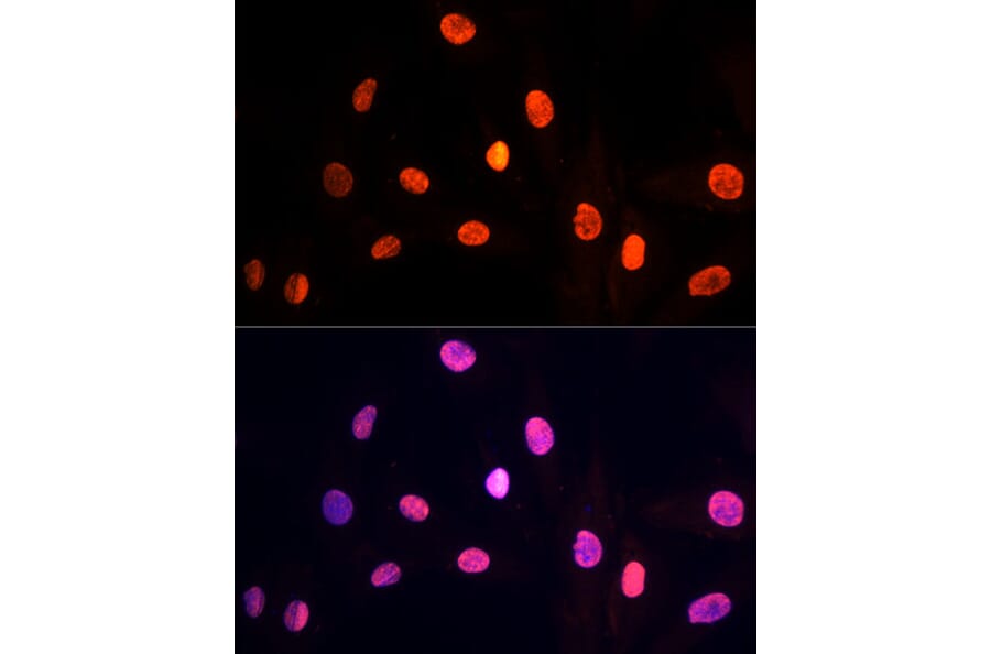 Immunofluorescence - Anti-PRP19 Antibody (A90482) - Antibodies.com