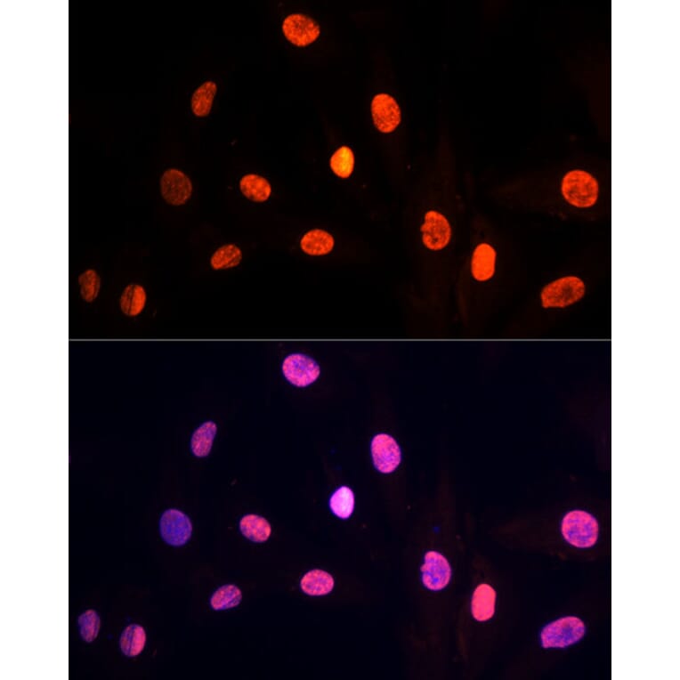 Immunofluorescence - Anti-PRP19 Antibody (A90482) - Antibodies.com