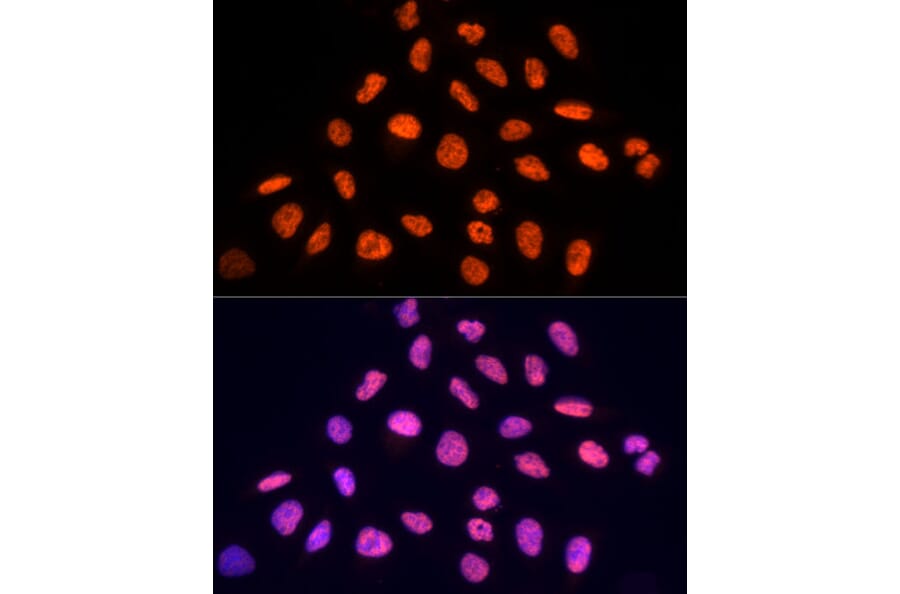 Immunofluorescence - Anti-PRP19 Antibody (A90482) - Antibodies.com