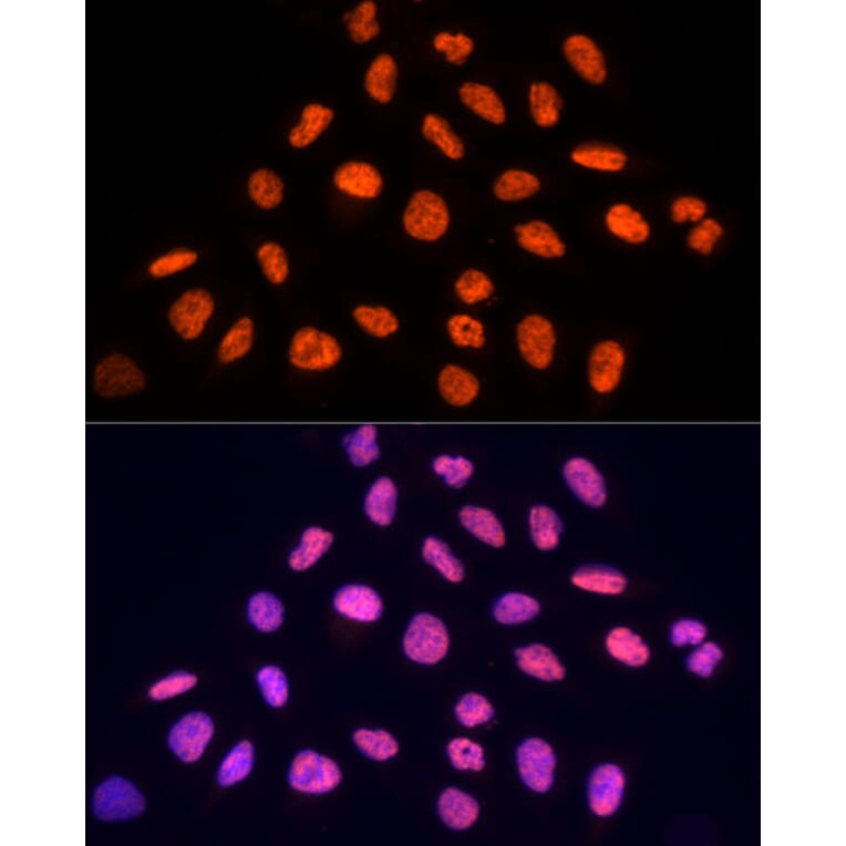 Immunofluorescence - Anti-PRP19 Antibody (A90482) - Antibodies.com