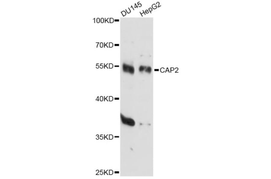 Western Blot - Anti-CAP2 Antibody (A14358) - Antibodies.com