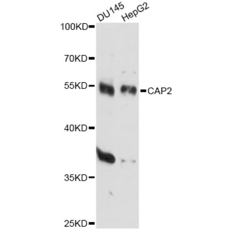 Western Blot - Anti-CAP2 Antibody (A14358) - Antibodies.com