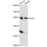 Western Blot - Anti-CAP2 Antibody (A14358) - Antibodies.com