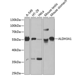 Western Blot - Anti-ALDH3A1 Antibody (A90484) - Antibodies.com