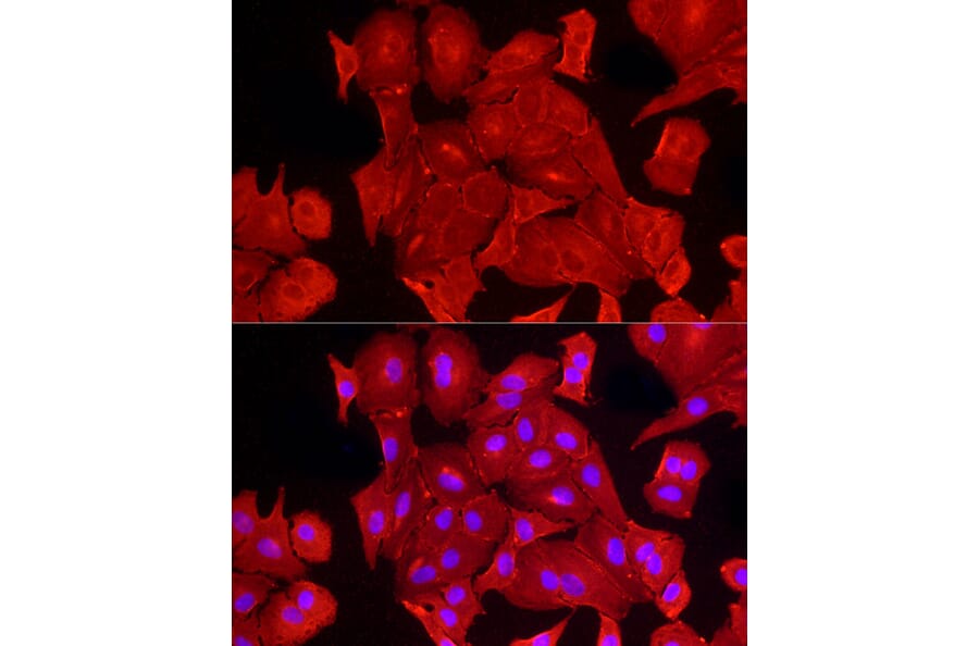 Immunofluorescence - Anti-ALDH3A1 Antibody (A90484) - Antibodies.com