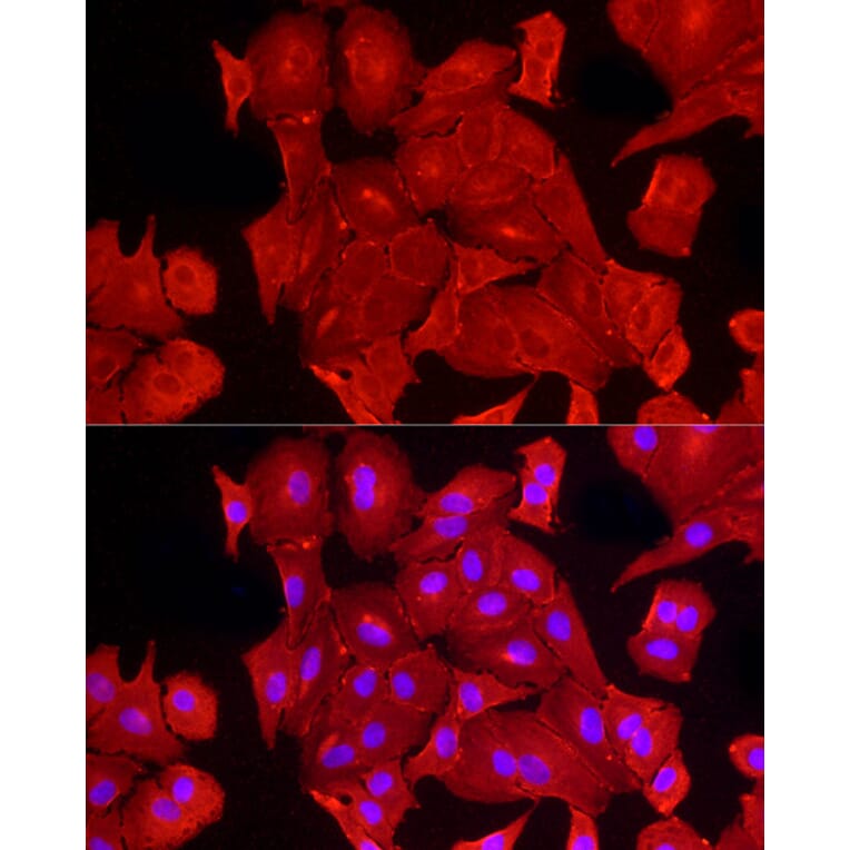 Immunofluorescence - Anti-ALDH3A1 Antibody (A90484) - Antibodies.com