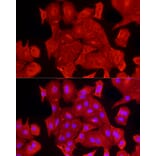 Immunofluorescence - Anti-ALDH3A1 Antibody (A90484) - Antibodies.com