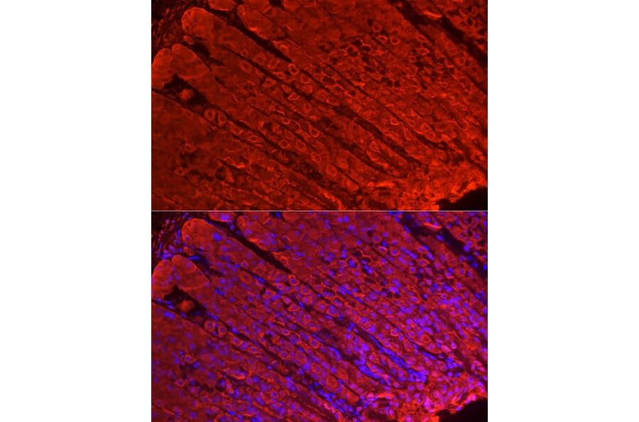 Immunofluorescence - Anti-ALDH3A1 Antibody (A90484) - Antibodies.com