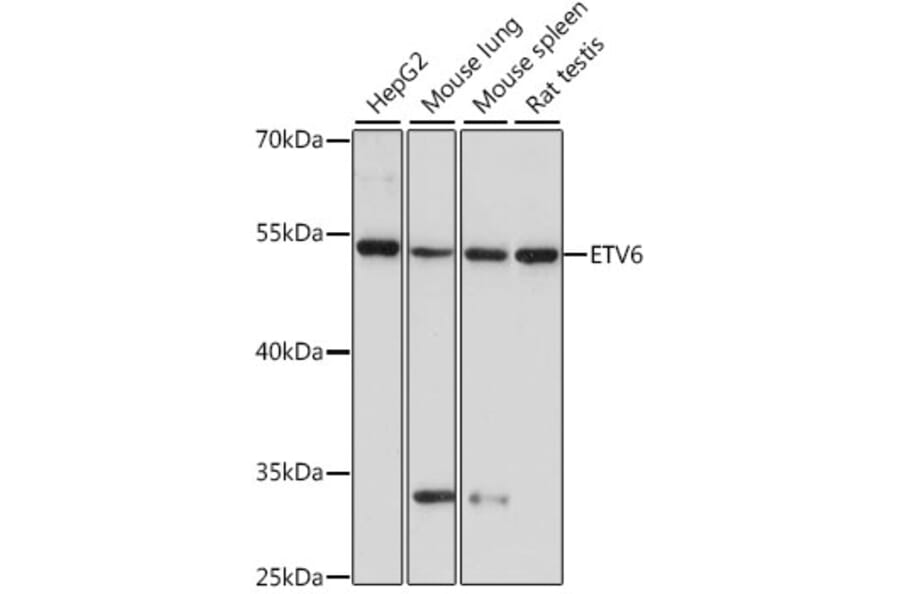 Western Blot - Anti-ETV6/Tel Antibody (A90485) - Antibodies.com