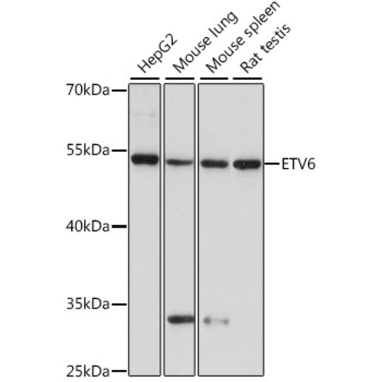 Western Blot - Anti-ETV6/Tel Antibody (A90485) - Antibodies.com