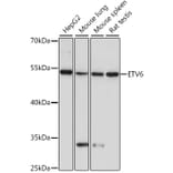 Western Blot - Anti-ETV6/Tel Antibody (A90485) - Antibodies.com