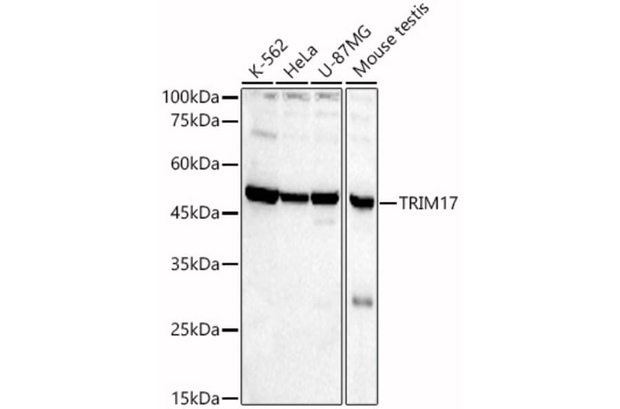 Western Blot - Anti-TRIM17 Antibody (A90486) - Antibodies.com