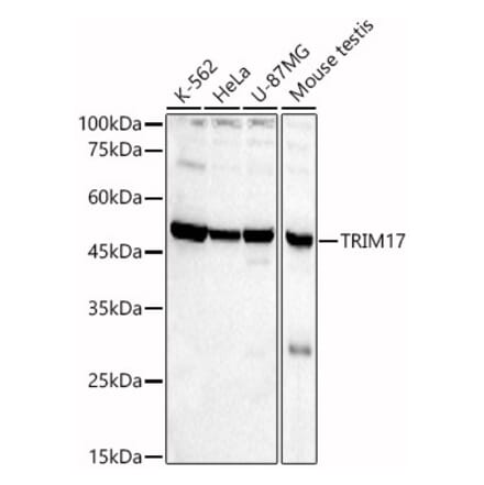 Western Blot - Anti-TRIM17 Antibody (A90486) - Antibodies.com