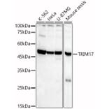Western Blot - Anti-TRIM17 Antibody (A90486) - Antibodies.com