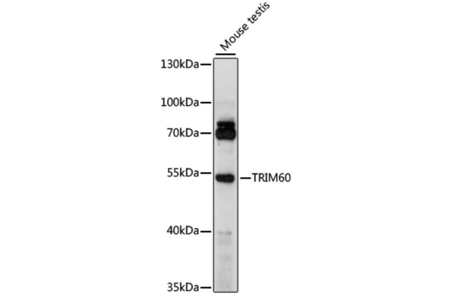 Western Blot - Anti-TRIM60 Antibody (A90487) - Antibodies.com