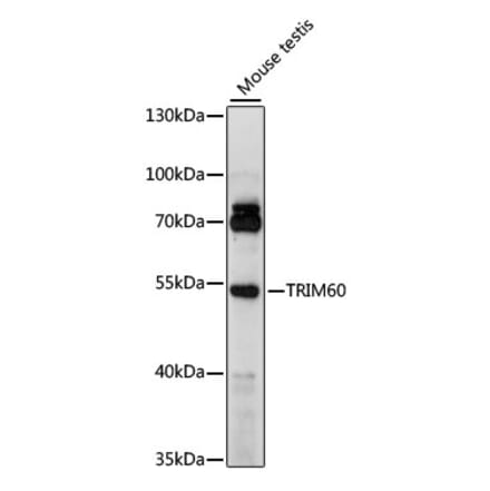 Western Blot - Anti-TRIM60 Antibody (A90487) - Antibodies.com