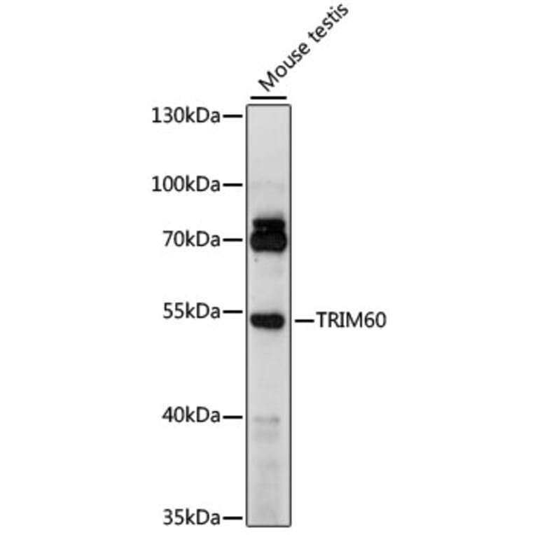 Western Blot - Anti-TRIM60 Antibody (A90487) - Antibodies.com