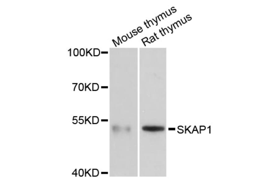 Western Blot - Anti-SKAP1 Antibody (A3345) - Antibodies.com