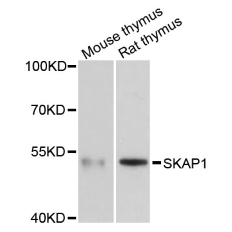 Western Blot - Anti-SKAP1 Antibody (A3345) - Antibodies.com