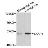 Western Blot - Anti-SKAP1 Antibody (A3345) - Antibodies.com