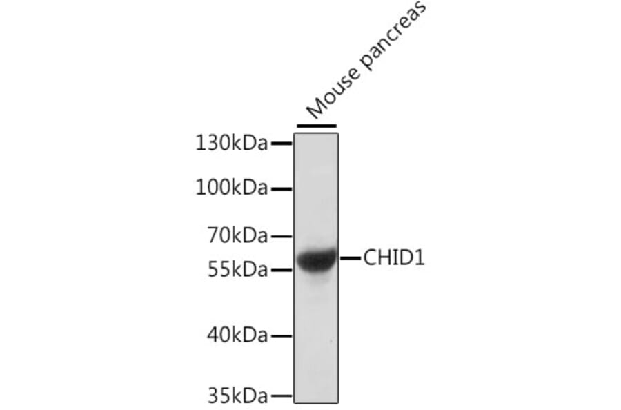 Western Blot - Anti-SI-CLP Antibody (A90491) - Antibodies.com