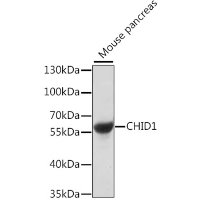 Western Blot - Anti-SI-CLP Antibody (A90491) - Antibodies.com