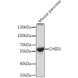 Western Blot - Anti-SI-CLP Antibody (A90491) - Antibodies.com