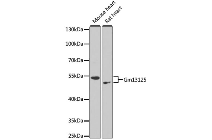 Western Blot - Anti-PRAMEF20 Antibody (A90492) - Antibodies.com