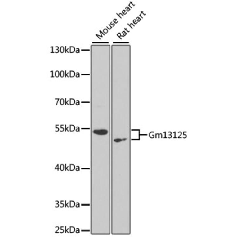 Western Blot - Anti-PRAMEF20 Antibody (A90492) - Antibodies.com