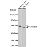 Western Blot - Anti-PRAMEF20 Antibody (A90492) - Antibodies.com