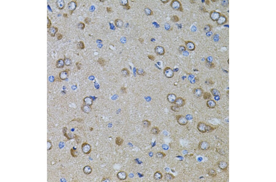 Immunohistochemistry - Anti-PRAMEF20 Antibody (A90492) - Antibodies.com
