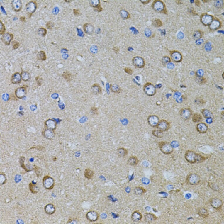 Immunohistochemistry - Anti-PRAMEF20 Antibody (A90492) - Antibodies.com